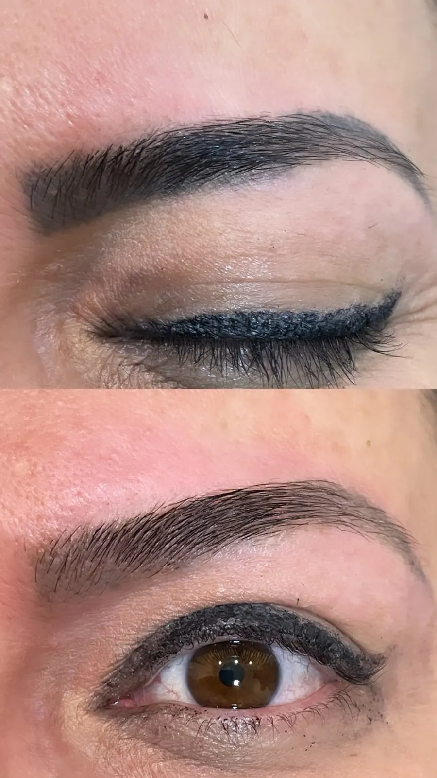 Antes e depois de remoção a laser de micropigmentação de sobrancelha